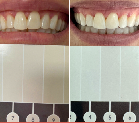 Buy 3 Get 1 FREE Whitening Toothpaste