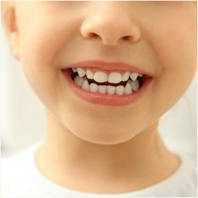 Close-up of a child's face with a focus on their teeth.